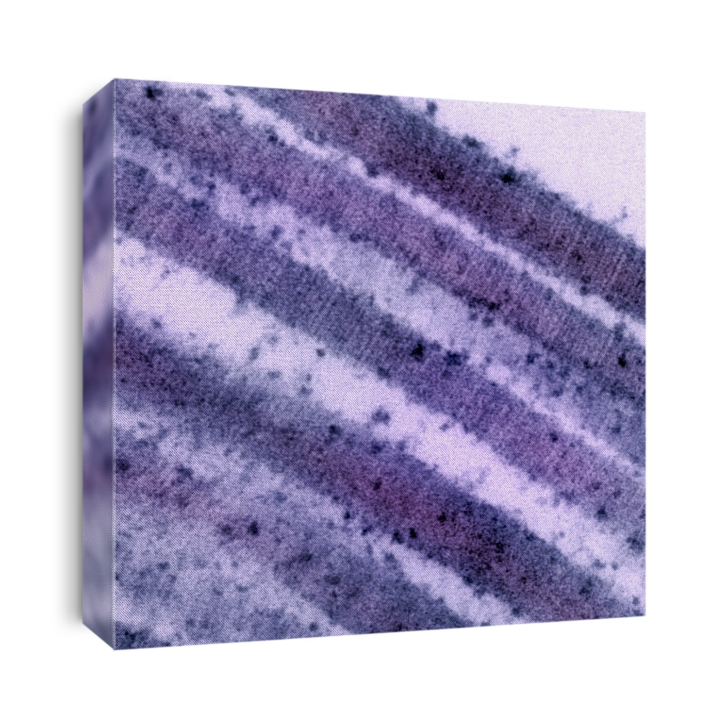 Mouse lung collagen. TEM X352,000 @ 7 inches